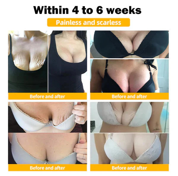 (Official Brand Store ) 𤰠LuvSnap⢠100% Natural Sagging Repair Patch or Breast Enhancement Patch